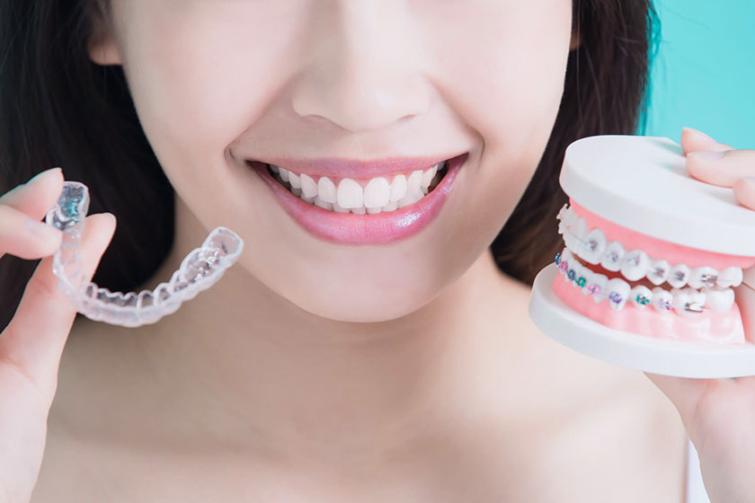 Denti storti, cause e rimedi per tornare a sorridere.